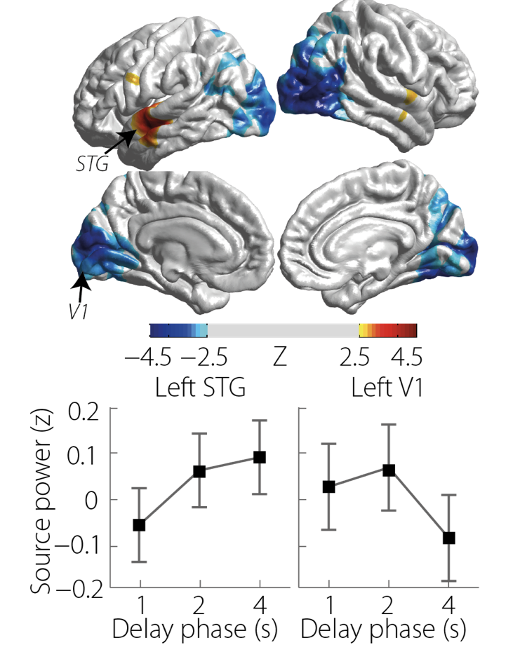 sensory memory brain